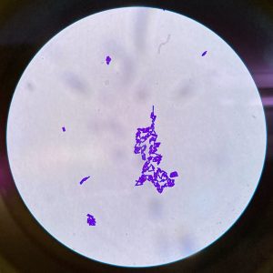 This is Caulobacter crescentus in the media made with tap water after one night of incubation. It can be identified because of C. crescentus’s slightly curved shape, small size, and what it looks like when it divides. 